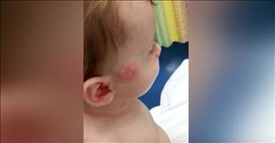 Mom Warns After Pacifier Sends Infant To ER 