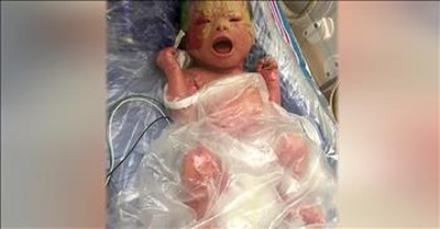 Rare Skin Condition Causes Newborn's Skin To Crack 