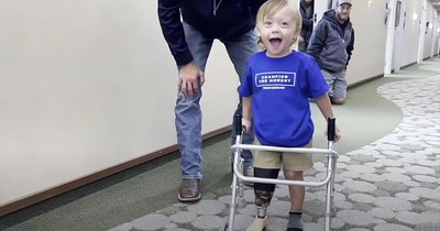 2-Year-Old Amputee Toddler Takes First Steps 