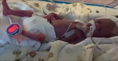 12-Ounce Premature Baby Defies Odds And Thrives 