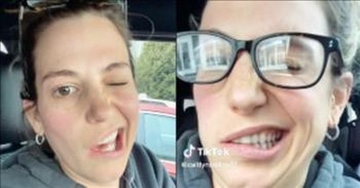 Woman Can’t Stop Laughing After Dentist Numbs Half Her Face 