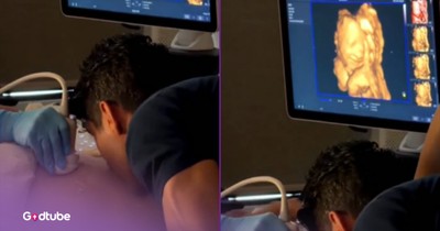 Baby Girl Smiles for Mom and Dad in Darling Ultrasound Picture