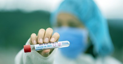 Coronavirus vaccine, Canadian Catholic bishop funds research for a safe and efficient coronavirus vaccine