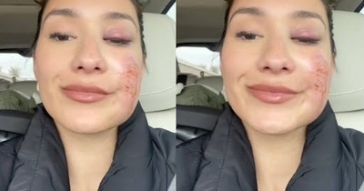 Car Accident on First Date Night Without Kids in a Year, Reminds Couple That God is in Control