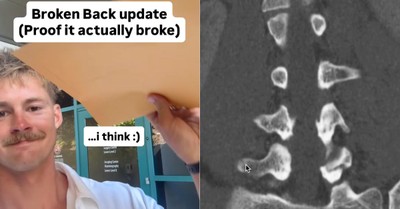 Forrest Frank Answers Critics of Miracle Claim with CT Scans