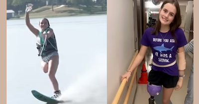 She Lost an Arm and a Leg in a Shark Attack, Now She is Committed to Making a Difference