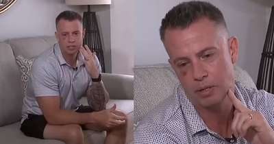 Father of 4 Survives Life-Threatening Accident After Tree Branch Nearly Reaches His Brain 