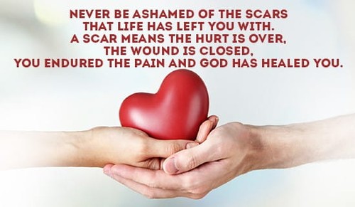 Never be ashamed of your scars...