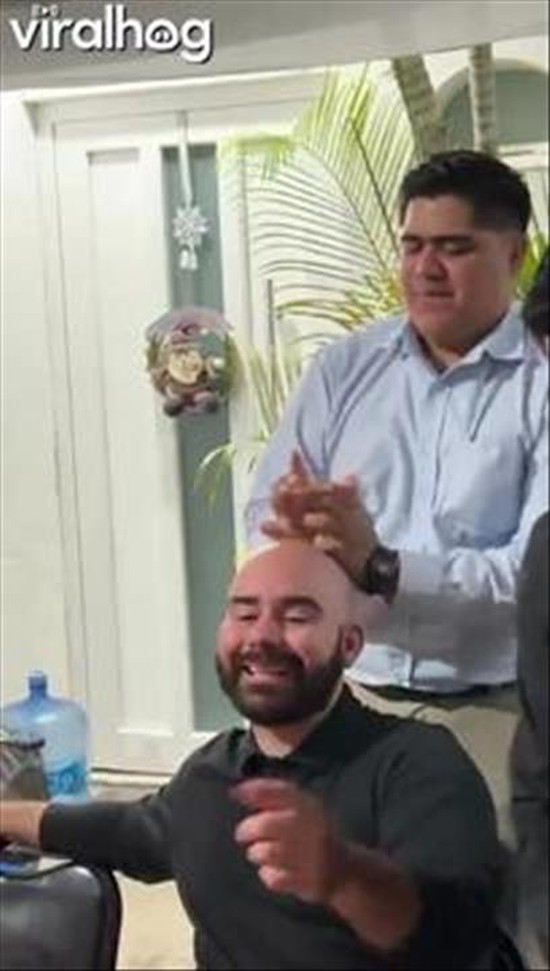Giving A Bald Man The Perfect Ponytail