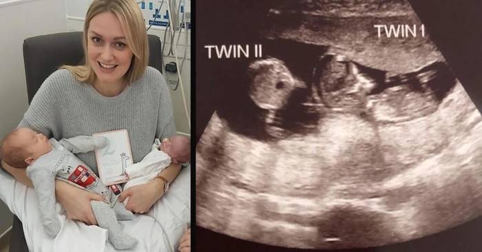 Nurse Goes Quiet during Ultrasound as She Realizes Woman Got Pregnant while Pregnant