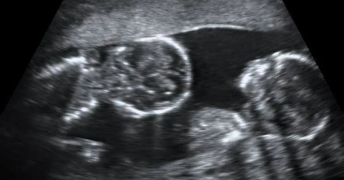 Two Babies Talk in the Womb and Perfectly Explain God