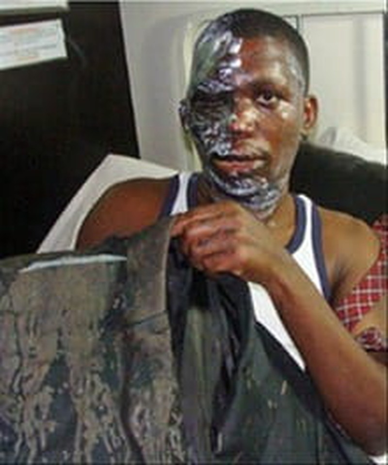 Muslim Extremists in Uganda Throw Acid on Bishop