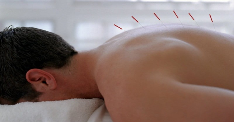 Is it Okay for Christians to Use Acupuncture?
