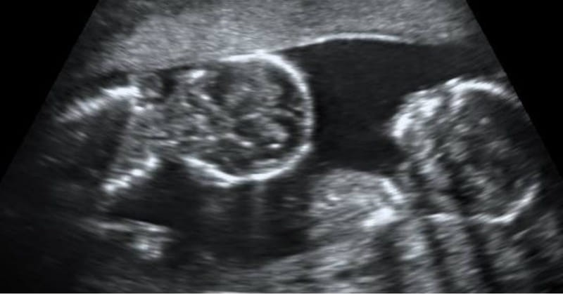 Boy or Girl? Parents Raising “Theybies”