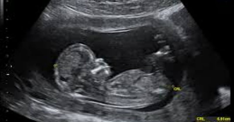 Atlantic Article Argues Pro-Lifers Use Ultrasounds for Political Purposes