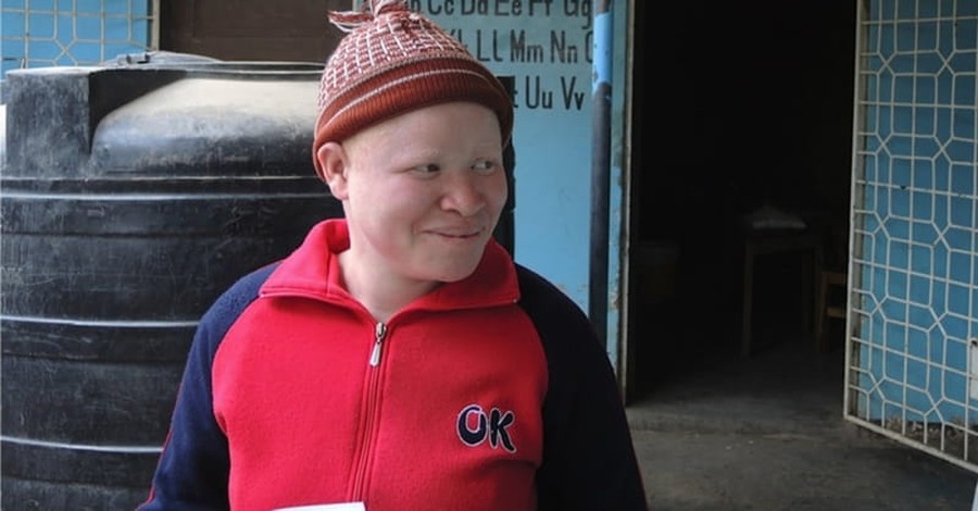 Illegal Trade in Body Parts Threatens Africans with Albinism
