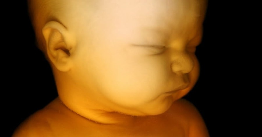27 Babies Born Alive and Left to Die at Australian Abortion Clinic