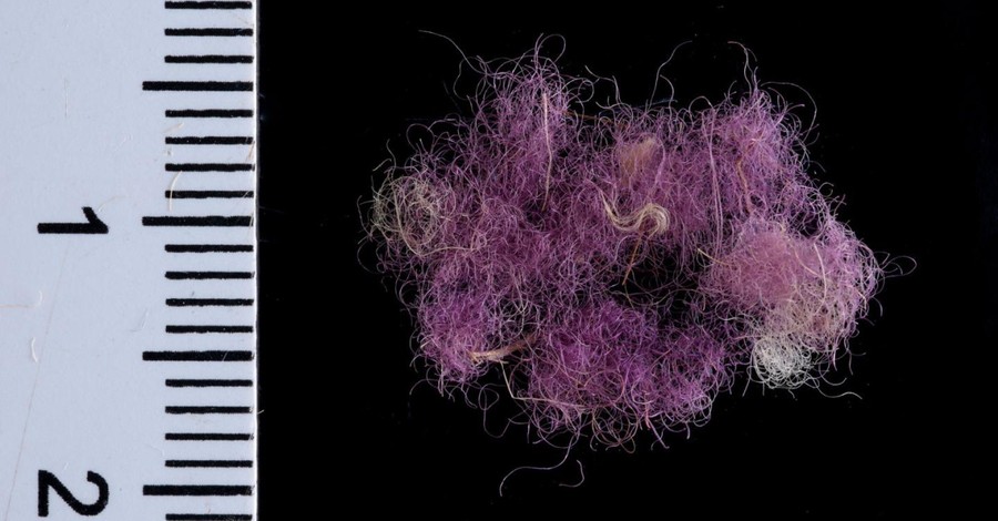 Biblical 'Royal Purple' Cloth from David's Era Unearthed by Israeli Archaeologists