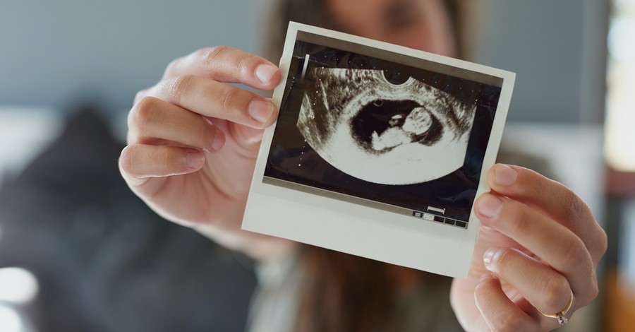 women holding photo up of baby in ultrasound image, Jeremiah 1:5 before I formed you I knew you