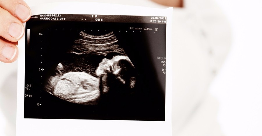 'Babies in the Womb': NBC's <em>Today</em> Surprises Pro-Lifers with 3D Ultrasound Story