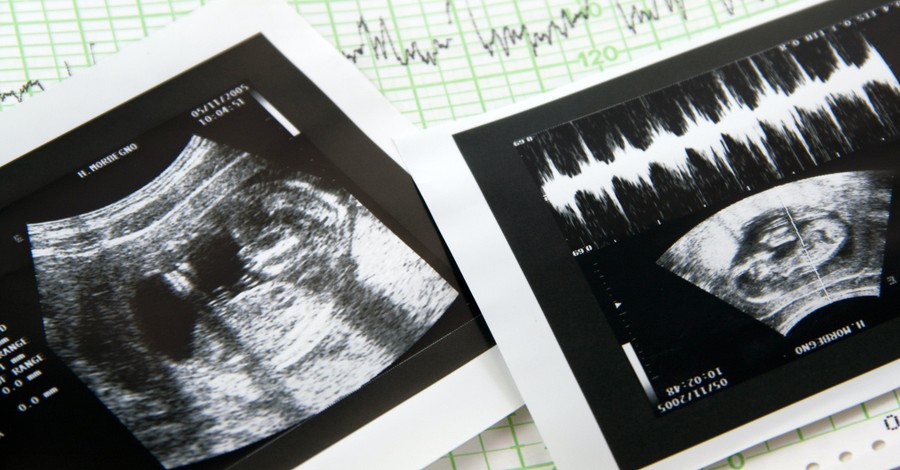 'Life Is Precious': Appeals Court Says Tenn. Can Ban Down Syndrome Abortions