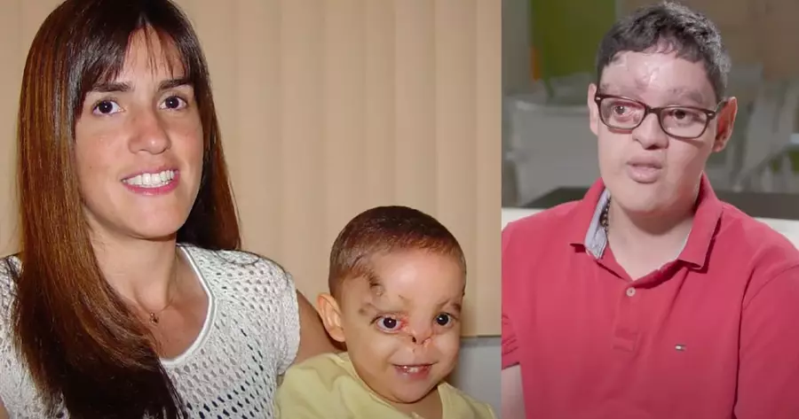 Doctors Thought He'd Never Survive, but Faithful Parents Refuse to Give Up on Baby with No Nose
