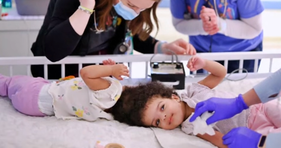 Twin Sisters Conjoined at the Head Successfully Separated in Life-Changing Surgery