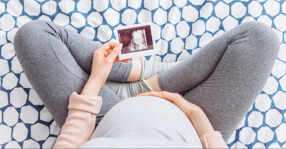 pregnant woman with a sonogram